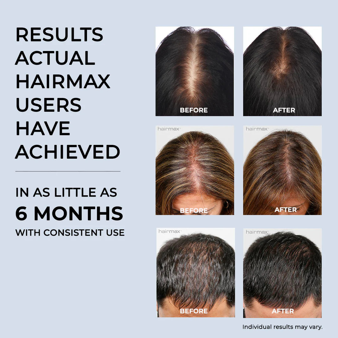HAIRMAX Actonis™ Dual Action18 лазерний гребінець для стимуляції росту волосся (заміна LaserComb Ultima 12) - Зображення 6